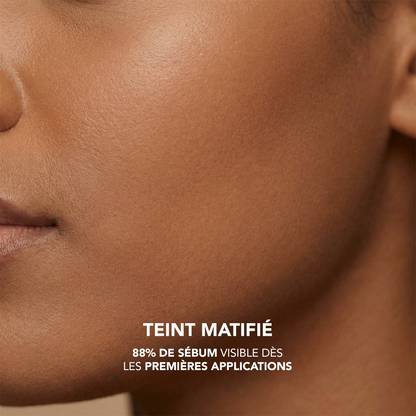 N5-T4: Niacinamide 5% + Tranexamic Acid 4% Serum