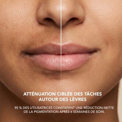 AA2: Alpha Arbutin 2% + Hyaluronic Acid Serum