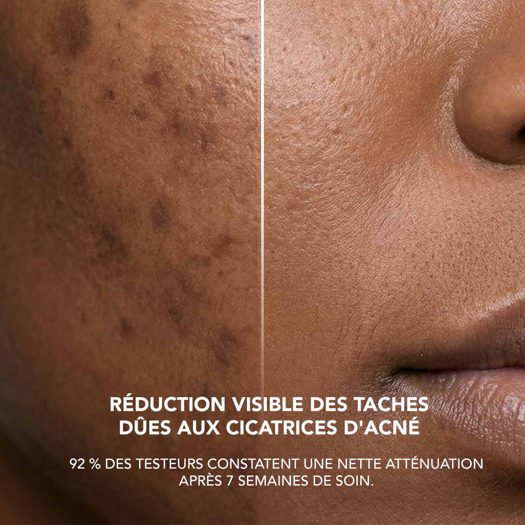AA2: Alpha Arbutin 2% + Hyaluronic Acid Serum