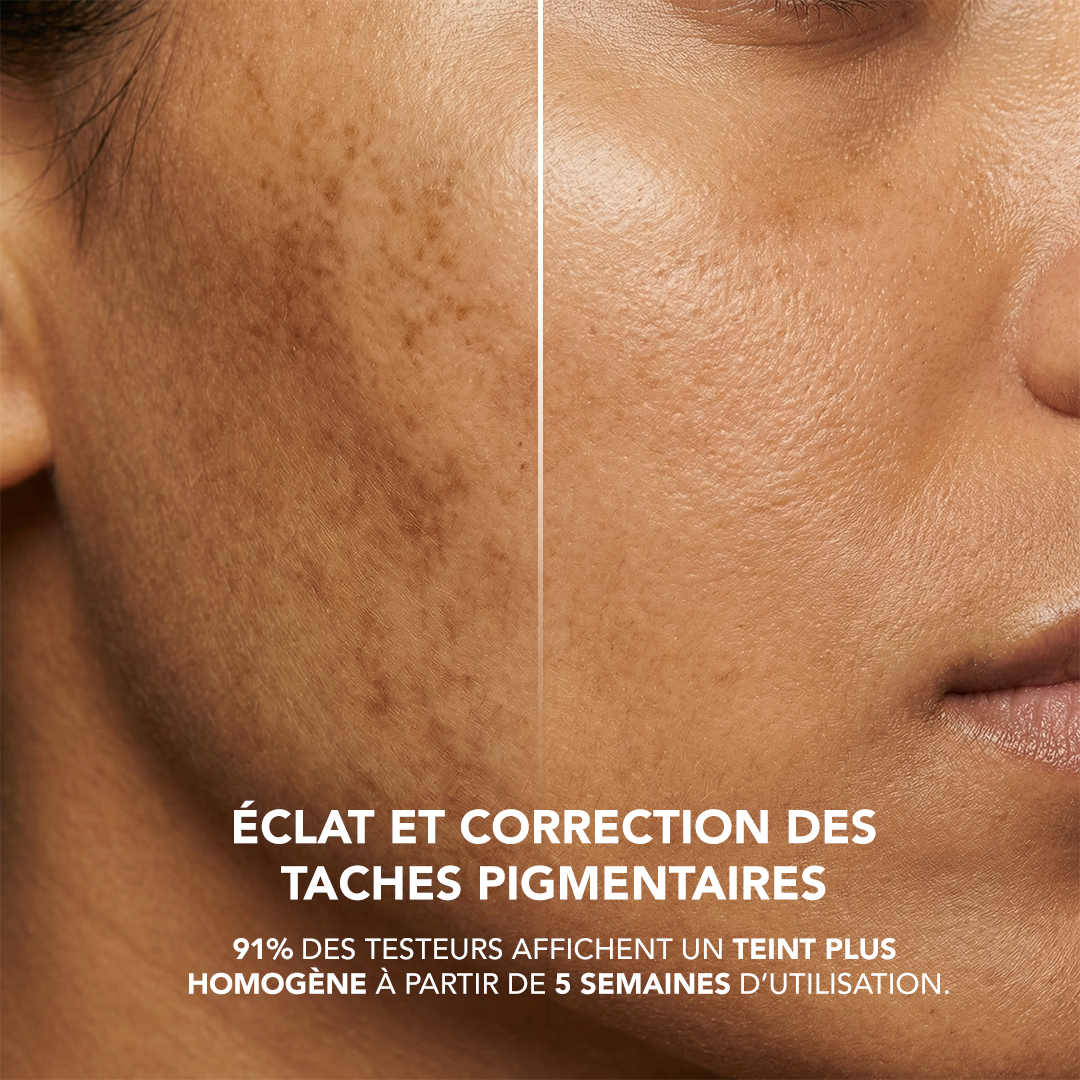 N5-T4: Niacinamide 5% + Tranexamic Acid 4% Serum