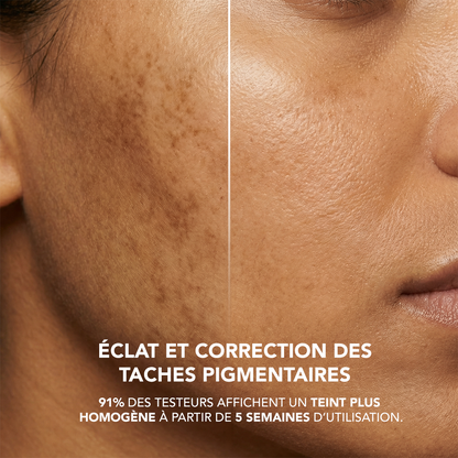 N5-T4: Niacinamide 5% + Tranexamic Acid 4% Serum
