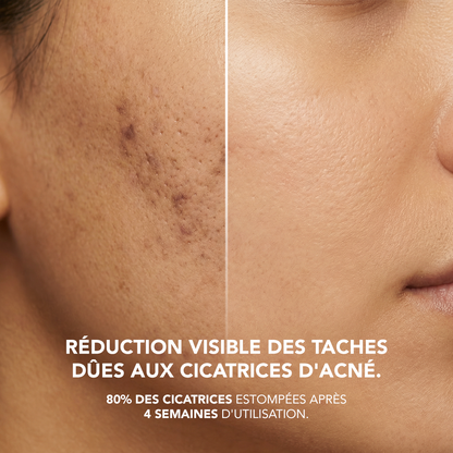 N5-T4: Niacinamide 5% + Tranexamic Acid 4% Serum